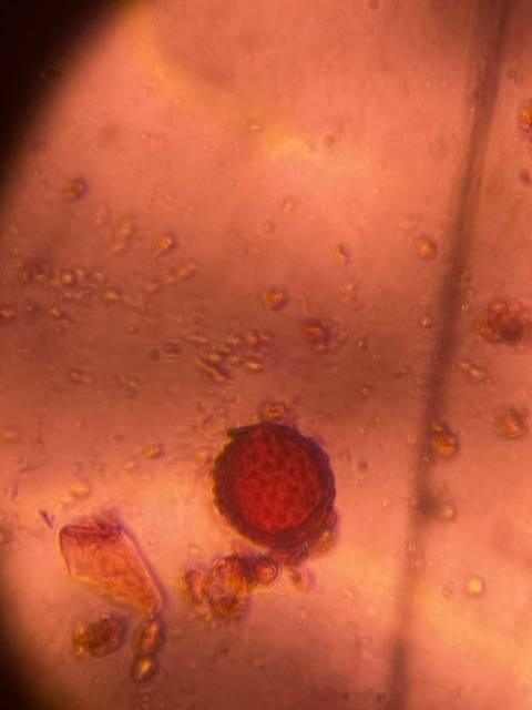 Microscope image of Chenopod — pollen (gallery) — verified by PollyMap