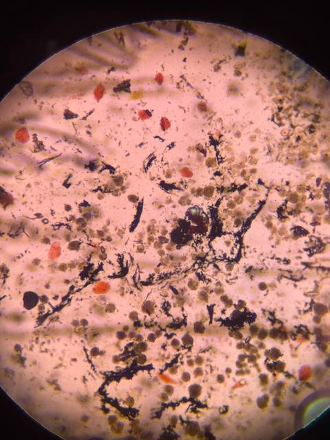 Microscope image of Unknown Dust/Soot — dust (reference) — verified by PollyMap