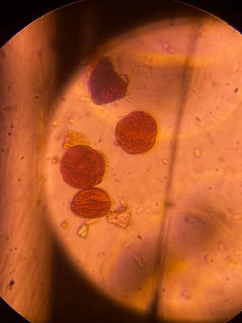Microscope image of Oak — pollen (gallery) — verified by PollyMap