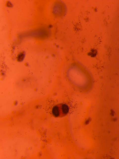 Microscope image of Pine — pollen (gallery) — verified by PollyMap