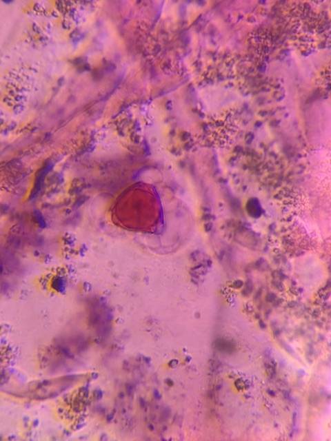 Microscope image of Eucalyptus — pollen (gallery) — verified by PollyMap