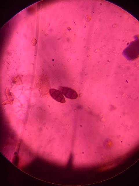 Microscope image of Pithomyces — mold (gallery) — verified by PollyMap