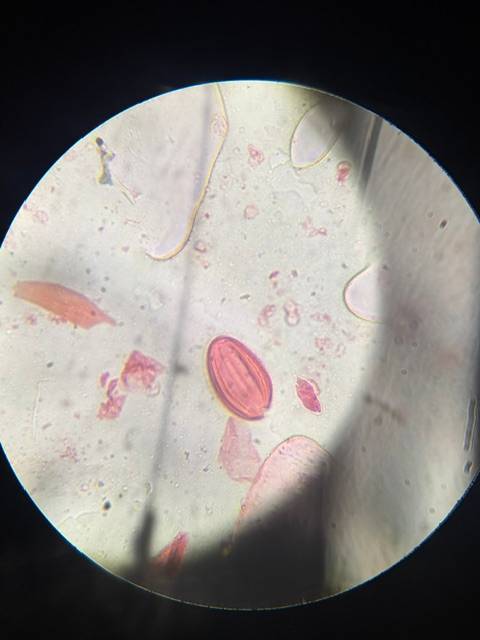 Microscope image of Ephedra — pollen (reference) — verified by PollyMap