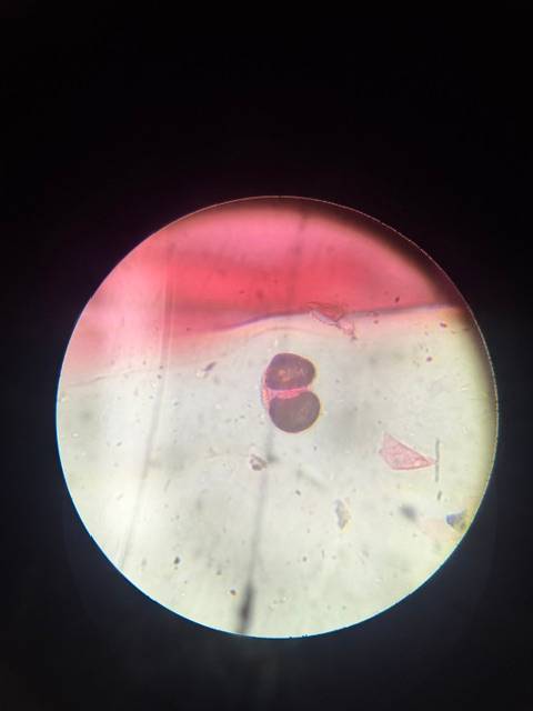 Microscope image of Pine (Pinus spp.) — pollen (gallery) — verified by PollyMap