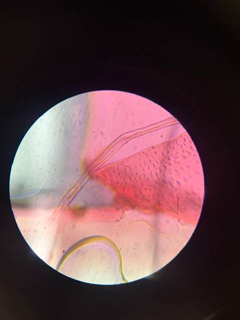 Microscope image of Dust Mite (Dermatophagoides sp.) — dust (reference) — verified by PollyMap