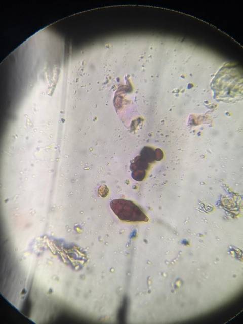 Microscope image of Aureobasidium — mold (reference) — verified by PollyMap